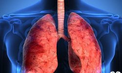 آیا ریه های شما سالم است؟