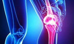 درمان زانو درد با ۸ ماده غذایی