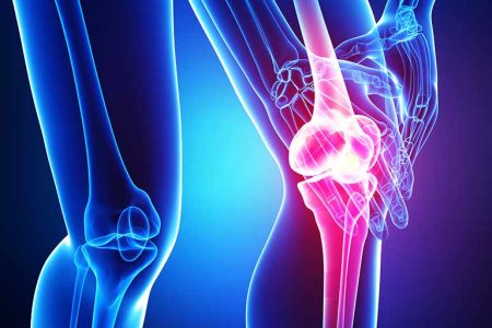 لیست بخور نخورهای مهم برای آرتروز