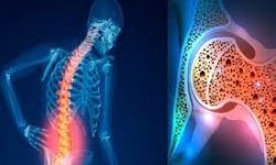 ۶ هشدار پوکی استخوان در مردان