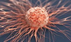 مدیرکل دفتر مدیریت بیماری های غیرواگیر وزارت بهداشت خبر داد؛ اجرای رایگان برنامه تشخیص زودرس سرطان های شایع در کشور