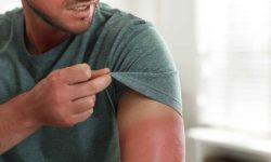 خطر بروز سرطان با آفتاب‌سوختگی/ توصیه‌هایی برای مراقبت از پوست در گرما