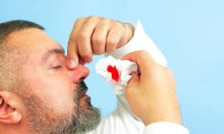 چگونه خون‌دماغ کودکمان را بند بیاوریم