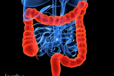 اینفوگرافیک / ۷ ماده غذایی موثر در پاکسازی روده بزرگ