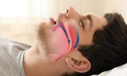 چگونه خروپف را درمان کنیم؟