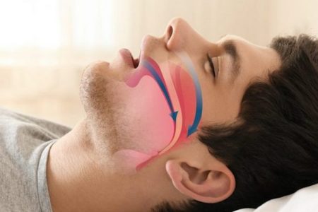 چگونه خروپف را درمان کنیم؟