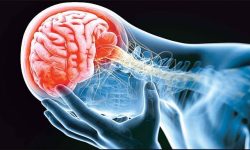 ۵ اقدام حیاتی در زمان بروز سکته مغزی