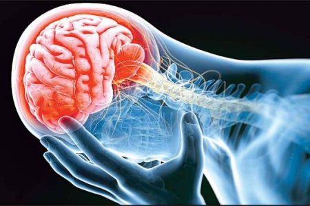 ۸ راهکار اساسی برای پیشگیری از سکته مغزی