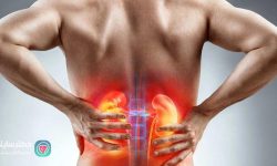 علائمی که ثابت می کند سنگ کلیه دارید