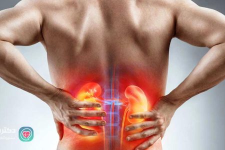 علائمی که ثابت می کند سنگ کلیه دارید