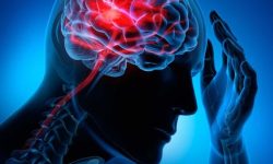 هفت نشانه پنهان تومور مغزی که ممکن است آن‌ها را عادی بپندارید