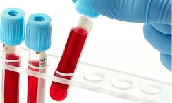 پیش‌بینی سرطان در مراحل اولیه با آزمایش خون