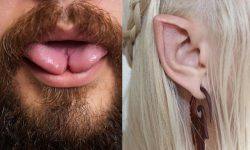 تب زیبایی‌ نامتعارف در ایران ؛ از نصف کردن زبان تا گوش الاغی / اتاق جراحی در زیرزمین خانه‌