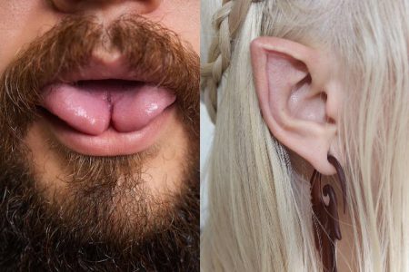 تب زیبایی‌ نامتعارف در ایران ؛ از نصف کردن زبان تا گوش الاغی / اتاق جراحی در زیرزمین خانه‌