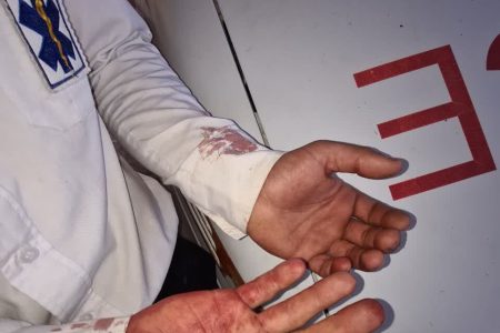 حمله افراد ناشناس به کارشناس اورژانس وخسارت به آمبولانس لالی