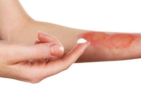 ترمیم سریع سوختگی با بانداژ ساخته‌شده از سیب، ذرت و سویا!