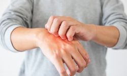 علت خارش شدید پوست و درمان فوری آن چیست؟