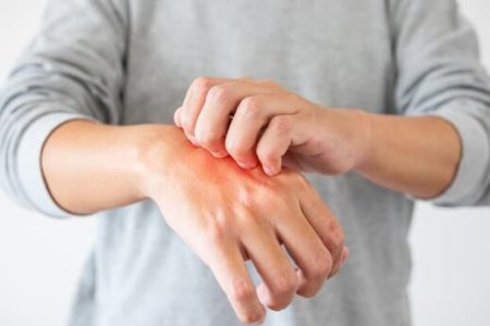 علت خارش شدید پوست و درمان فوری آن چیست؟