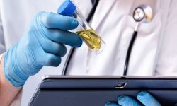 تشخیص سرطان از طریق ادرار ممکن می شود