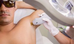 قبل از انجام لیزر این نکات را بخوانید