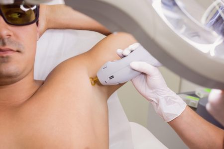 قبل از انجام لیزر این نکات را بخوانید