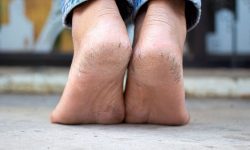 کمبود کدام ویتامین ها باعث پوسته شدن کف پا می شود ؟ / علت ترک پاشنه پا را بدانید/ درمان ترک پا با ۹ راهکار خانگی ساده