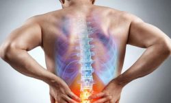 درمان دردهای ستون فقرات بدون تیغ جراحی!
