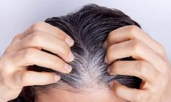 راهکار جلوگیری از خاکستری شدن موها
