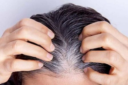 کمبود این ویتامین‌ها باعث سفیدی مو می‌شود / سفیدی زودرس موها پیش از ۴۰ سال چه دلایلی دارد؟ + راه‌های درمان آن