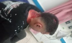 حمله دستفروشان به مأموران اجرائیات شهرداری مسجدسلیمان باعث جراحت شدید یکی از کارکنان شد