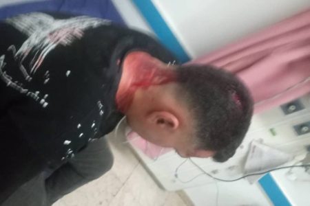 حمله دستفروشان به مأموران اجرائیات شهرداری مسجدسلیمان باعث جراحت شدید یکی از کارکنان شد