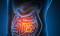 داروهای رایج مانند قرص سرماخوردگی و دیازپام می‌توانند تا سال‌ها بر سلامت روده اثر بگذارند