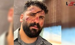 عکس میلاد کرمی بلاگر معروف به وضعتان چونه بعد از سقوط از کوه ../ اینبار وضعتان خرابه …