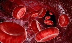 غلظت خون چیست و چه علائمی دارد؟ 