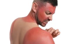 تنها یک آفتاب‌سوختگی شدید می‌تواند سلامت ما را برای همیشه تغییر دهد